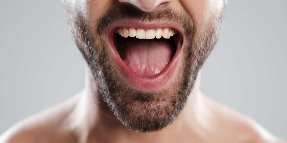 Ši dėmė ant liežuvio gali reikšti pavojingą organizmo išsausėjimą – patikrinkite tai nedelsdami