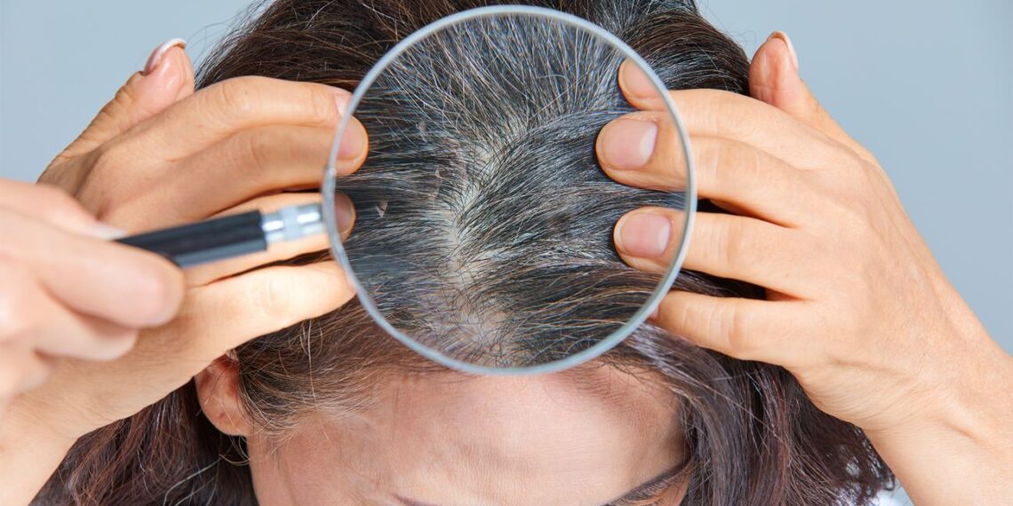 Ukrainietėms atverta geniali TOP stilisto gudrybė: kaip akimirksniu paslėpti žilus plaukus!