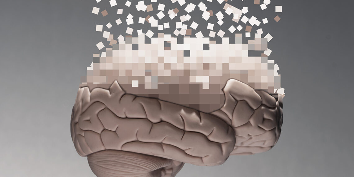 10 000 smegenų skenavimų atskleidė šokiruojančią tiesą: štai kodėl senstant išgaruoja atmintis