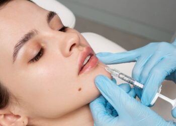 4 pavojingi atvejai, kai privalu skubiai tirpdyti lūpų ﬁlerį: gydytojai įspėja, kas nutiks