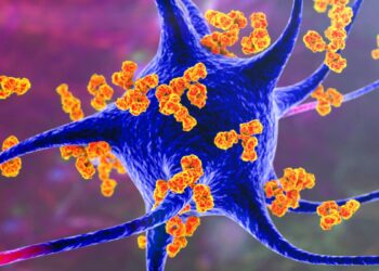 Amžinieji chemikalai siejami su išsėtine skleroze: naujas tyrimas gąsdina mokslininkus