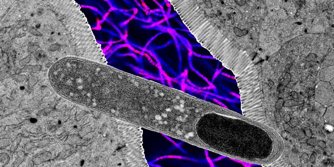 Atrasta žarnyno bakterija tirpdo riebalus: pelių svoris nekilo net valgant itin riebiai