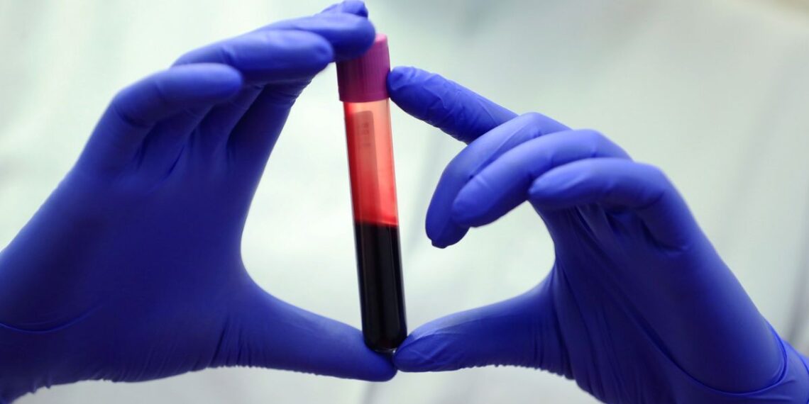 Atskleista ilgaamžiškumo paslaptis: ypatingai ilgai gyvenančių žmonių kraujas pribloškė mokslininkus