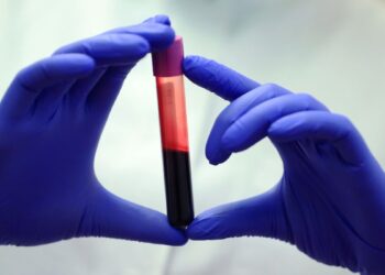 Atskleista ilgaamžiškumo paslaptis: ypatingai ilgai gyvenančių žmonių kraujas pribloškė mokslininkus