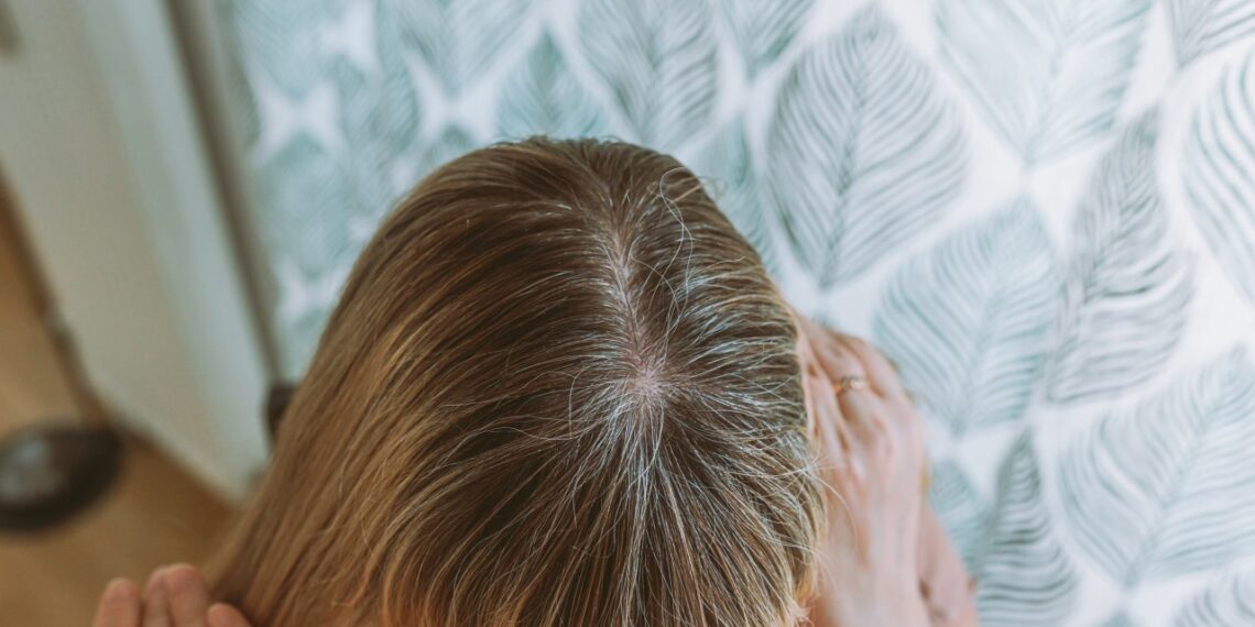 Dermatologė perspėja: po 40-ies šita klaida plonina plaukus – štai ką daryti, kad ataugtų tankesni