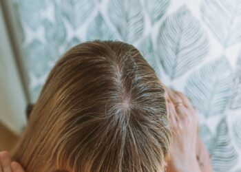 Dermatologė perspėja: po 40-ies šita klaida plonina plaukus – štai ką daryti, kad ataugtų tankesni