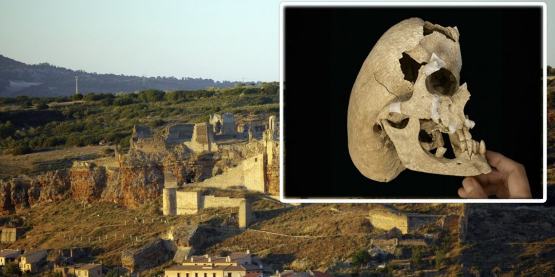 Ispanijoje rado viduramžių riterį su šiurpia kaukolės deformacija: mokslininkai priblokšti