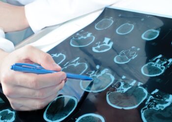 Lenkų mokslininkų revoliucija: naujas vaistų leidimo būdas žada lūžį gydant smegenų vėžį