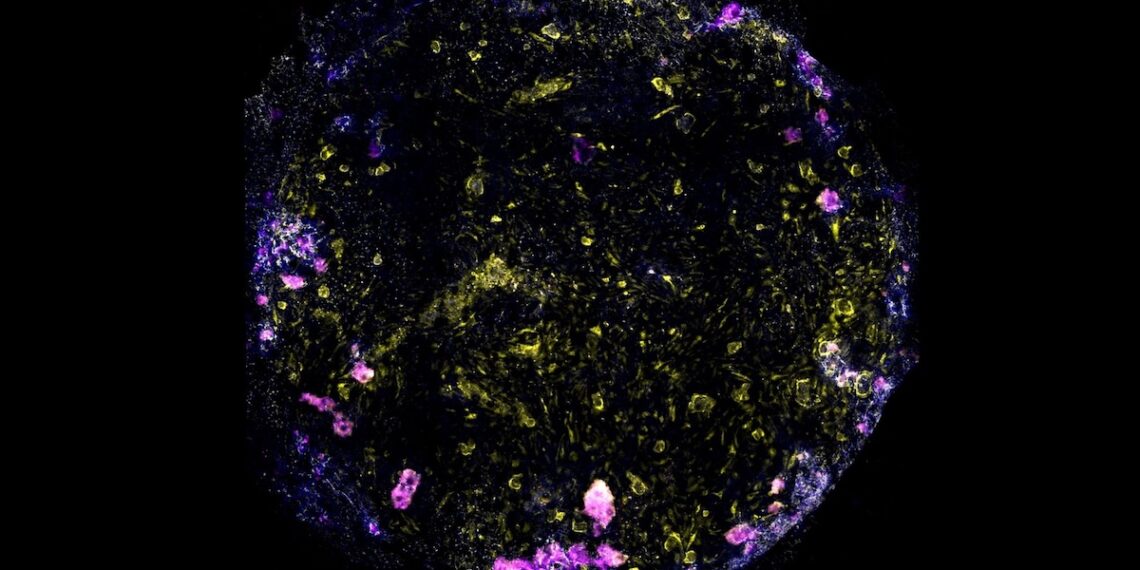 Mokslininkai privertė dirbtines plaučių ląsteles kvėpuoti – tada užkrėtė jas tuberkulioze