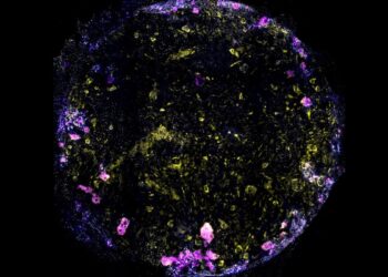 Mokslininkai privertė dirbtines plaučių ląsteles kvėpuoti – tada užkrėtė jas tuberkulioze