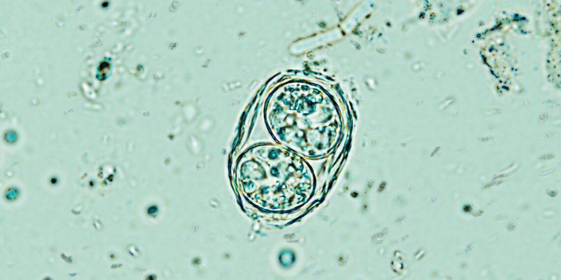 Mokslininkus šokiravo atradimas: milijonus užkrėtęs smegenų parazitas bunda ir siautėja jūsų galvoje
