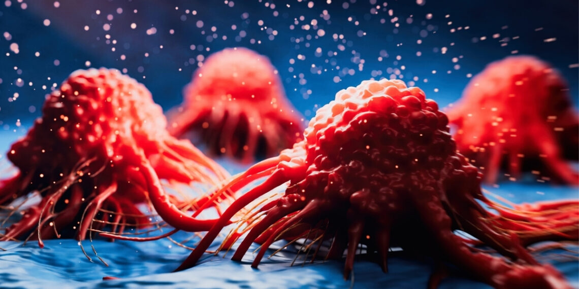 Mokslininkus šokiravo atradimas: vėžys gali skleisti signalus, saugančius smegenis nuo Alzheimerio