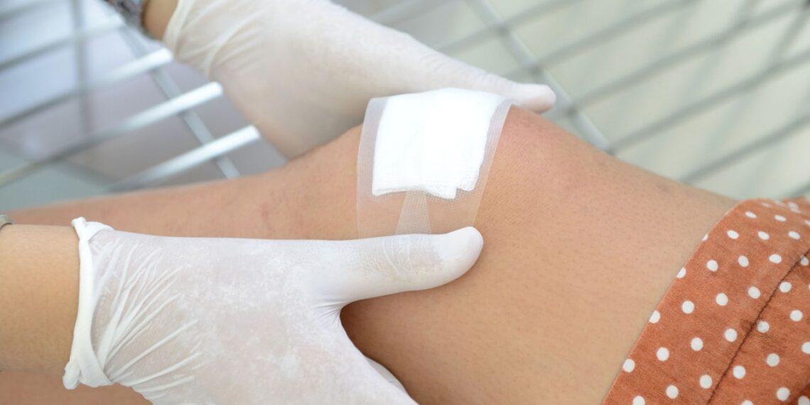 Naujas stebuklingi milteliai sustabdo mirtiną kraujavimą per SEKUNDĘ: ar tai revoliucija medicinoje?