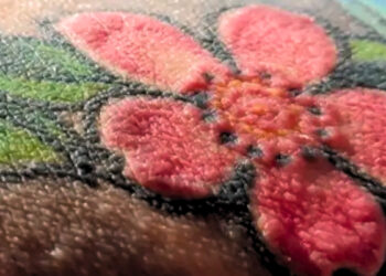 Raudonos tatuiruotės lenkui virto košmaru: imuninė sistema sukilo taip, kaip gydytojai nė nesapnavo