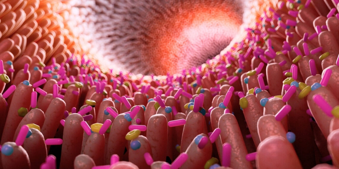 Šokiruojantis atradimas: žarnyno uždegimas vėl siejamas su Alzheimerio liga – rizika didėja