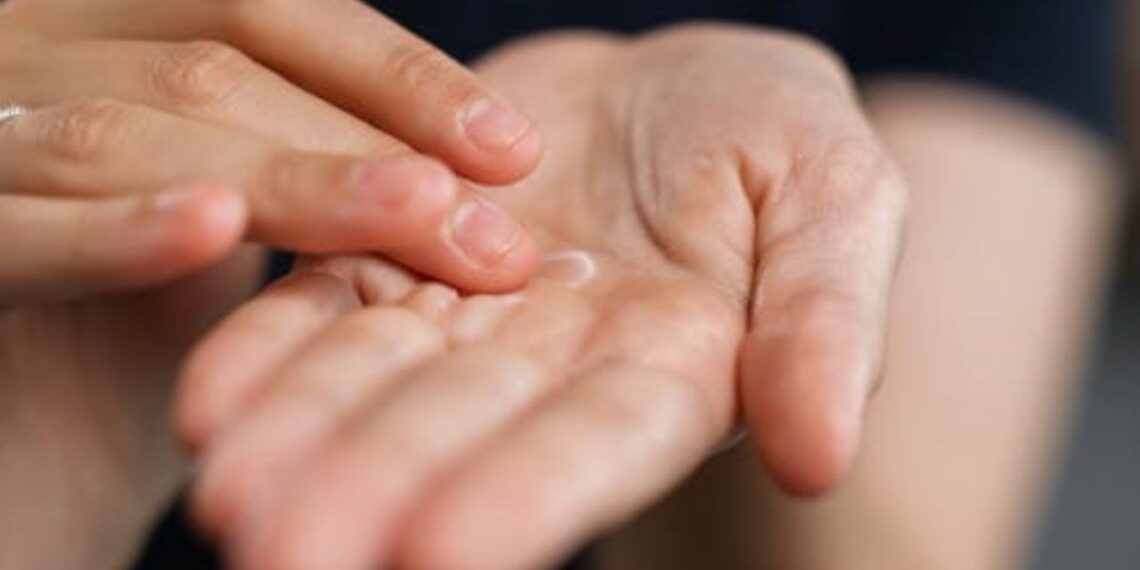 Sausoms ir suskeldėjusioms rankoms – paprasta priemonė iš vaistinės, kainuojanti vos kelis eurus