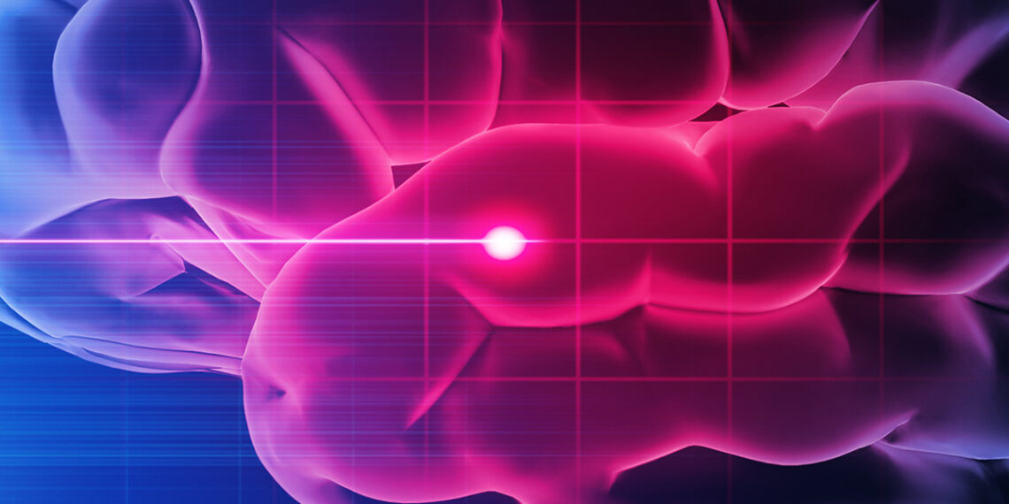 Stebuklingas peptidų gydymas po insulto? Mokslininkai atrado būdą apsaugoti smegenis nuo žalos