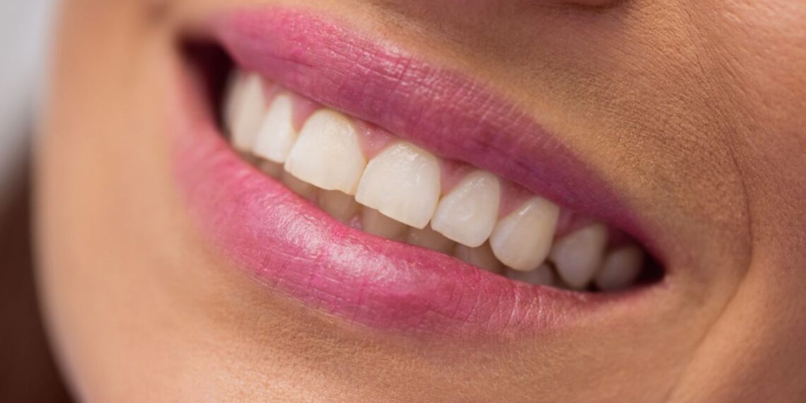 Stomatologai šokiruoti: vienas paprastas veiksmas po kiekvieno valgymo išgelbės jūsų dantis nuo žlugimo