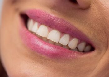 Stomatologai šokiruoti: vienas paprastas veiksmas po kiekvieno valgymo išgelbės jūsų dantis nuo žlugimo