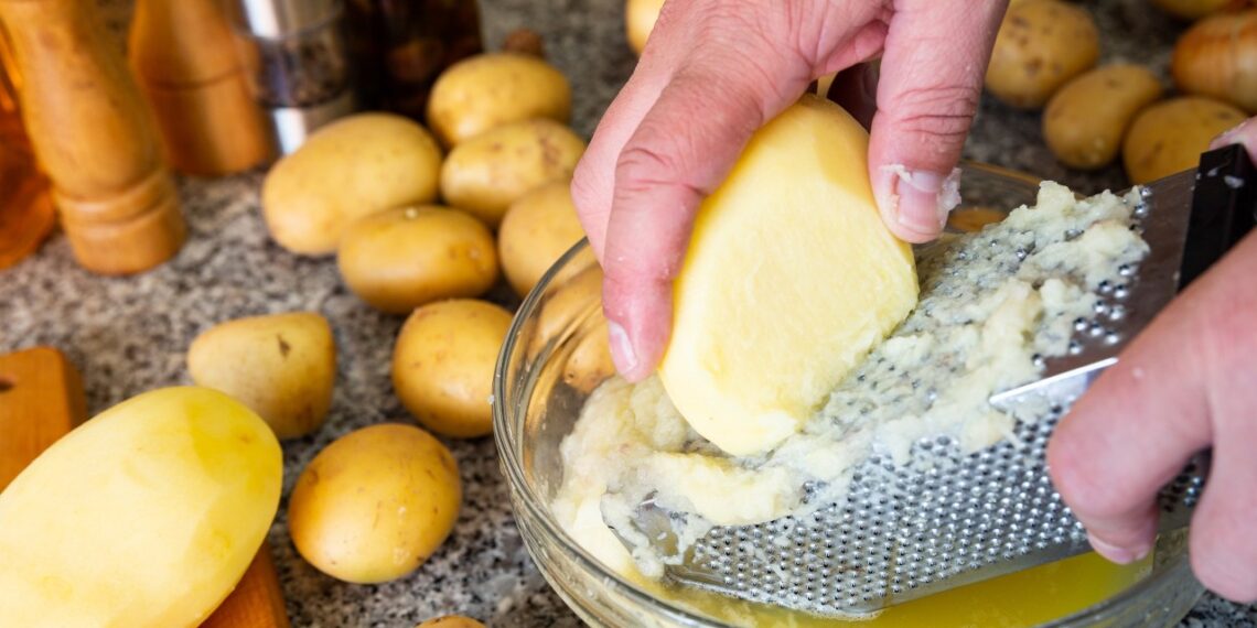 Uždėk ant odos ir lauk stebuklo: žalių bulvių kaukė numalšina skausmą, gydo ir lieknina