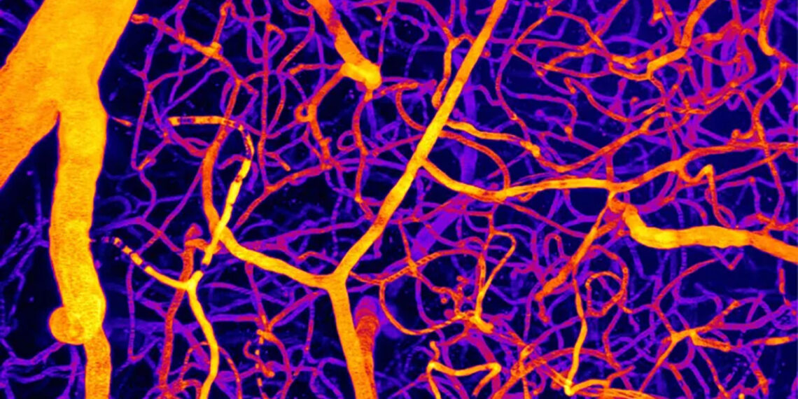 Vienas smegenų molekulės atradimas atskleidžia, kaip kraujotaka tyliai įjungia demenciją