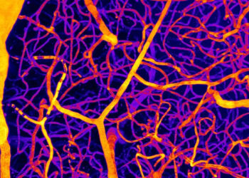 Vienas smegenų molekulės atradimas atskleidžia, kaip kraujotaka tyliai įjungia demenciją