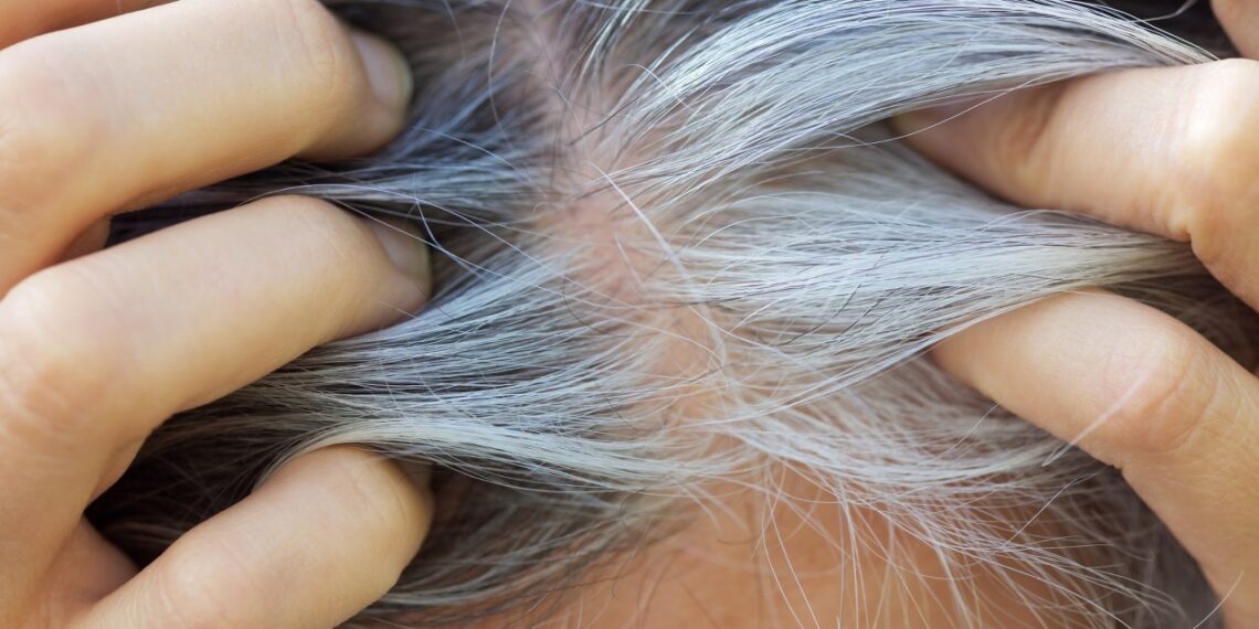 Žili plaukai išnyksta, o plaukai stiprėja: kodėl vis daugiau žmonių renkasi chną