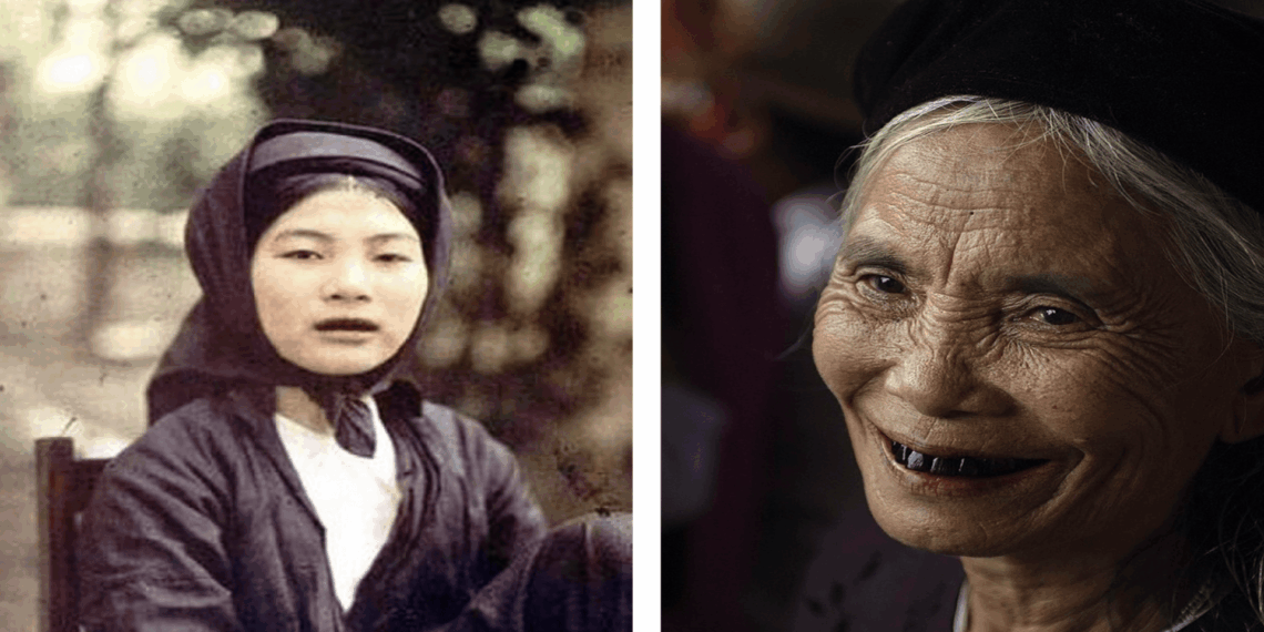 Senovės grožio standartai? Kapas atskleidė netikėtą dantų juodinimo istoriją