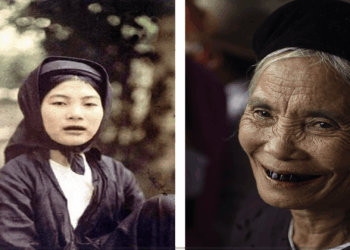 Senovės grožio standartai? Kapas atskleidė netikėtą dantų juodinimo istoriją