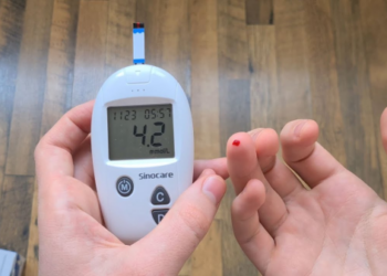 Ar citrina gali padėti sumažinti cukraus kiekį kraujyje? Gydytojus sudominęs paprastas triukas