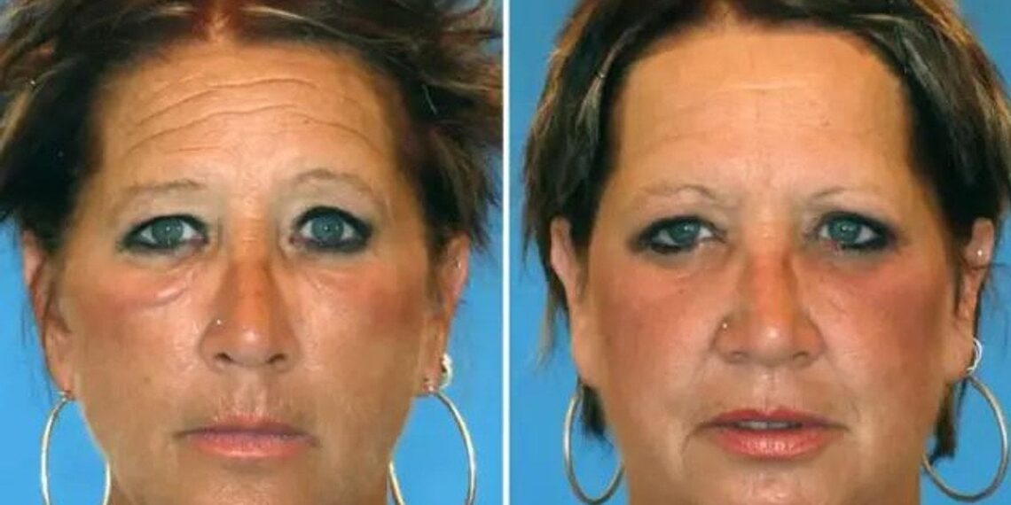 Dvynių eksperimentas šokiruoja: cigaretės ir saulė paliko ryškius pėdsakus