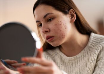 Gydytoja perspėja: dažna žarnyno problema, kurią ignoruoja lietuviai, baigiasi bėrimais visame kūne