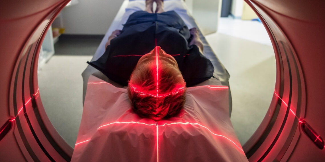 Vienas kasdienis įprotis gali pristabdyti Alzheimerio simptomus