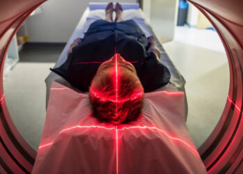 Vienas kasdienis įprotis gali pristabdyti Alzheimerio simptomus