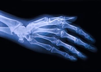 Mokslininkai atrado netikėtą būdą, kaip sustabdyti sąnarių dėvėjimąsi ir sumažinti osteoartrito skausmą