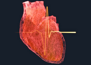 Mokslininkai atskleidė lemtingą amžių, kai vyrų infarkto rizika šokteli į neregėtas aukštumas