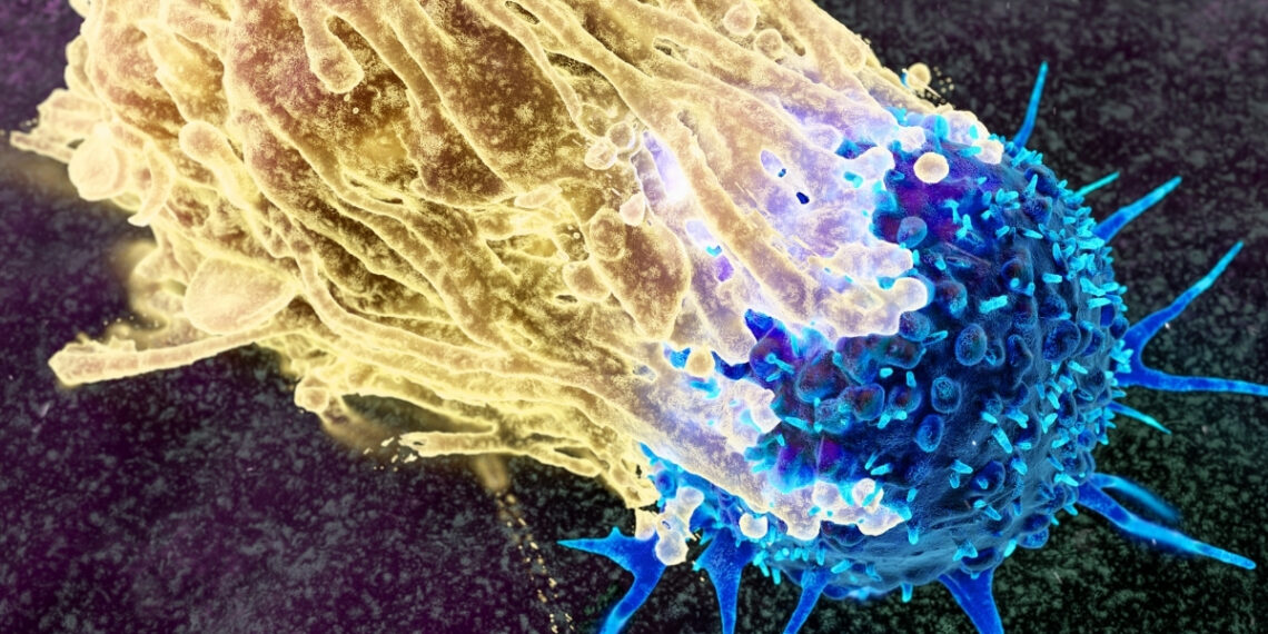 Mokslininkai pristatė planą, kaip sustabdyti vėžį dar prieš jam atsirandant