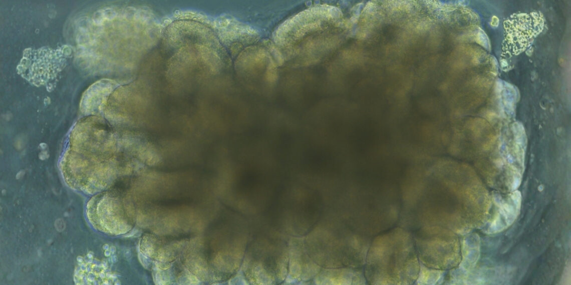 Mokslininkai laboratorijoje išaugino mini smegenis: jos pradėjo mokytis pačios