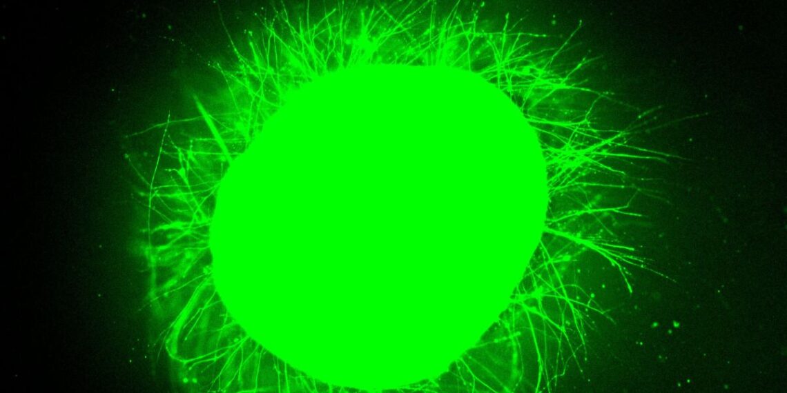 Mokslininkai laboratorijoje išaugino miniatiūrinius žmogaus stuburus