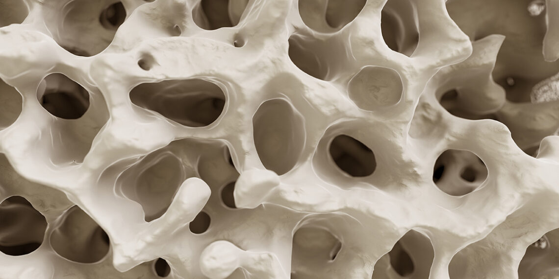 Ar įmanoma pristabdyti osteoporozę? Mokslininkai mini konkrečią mankštą