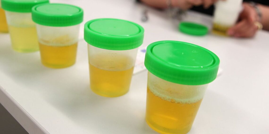 Proveržis energetikoje: šlapimas gali tapti nauju švarios energijos šaltiniu