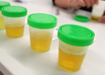 Proveržis energetikoje: šlapimas gali tapti nauju švarios energijos šaltiniu