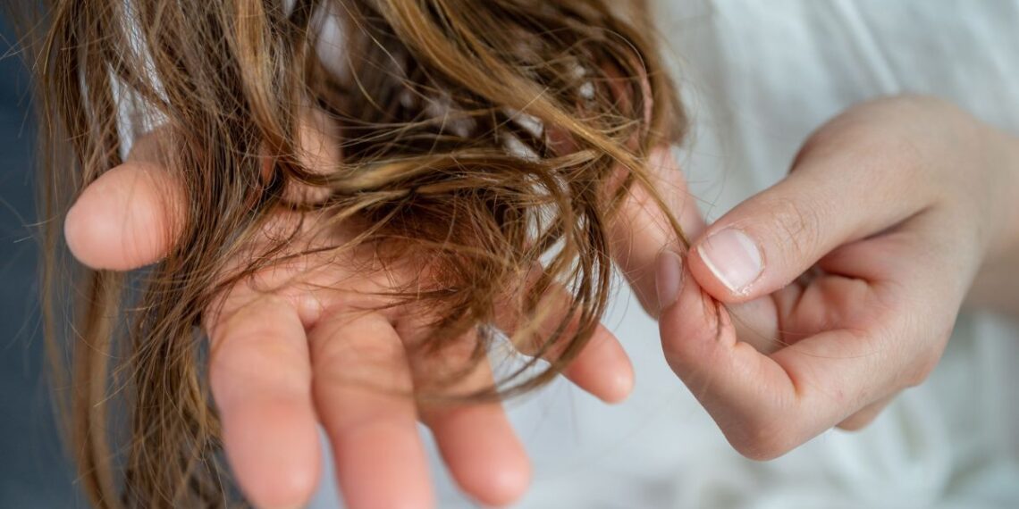 Netikėtas atradimas: Parkinsono ligos pėdsakai gali būti aptinkami plaukuose