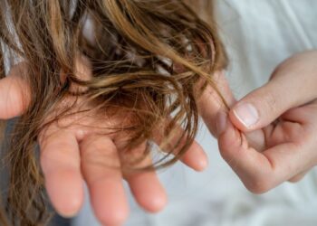 Netikėtas atradimas: Parkinsono ligos pėdsakai gali būti aptinkami plaukuose