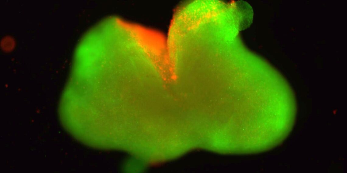 Medicinos revoliucija? Naujas audinys atveria kelią paralyžiaus gydymui