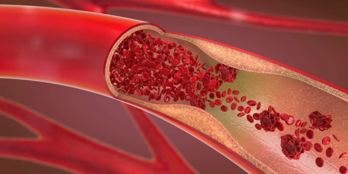 Daugiau nei 60 proc. mažesnis cholesterolis: kas tai per vaistas?