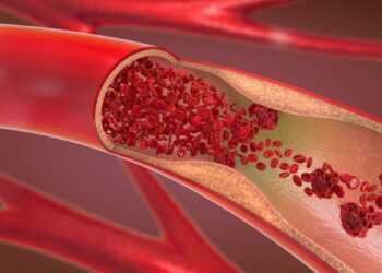 Daugiau nei 60 proc. mažesnis cholesterolis: kas tai per vaistas?