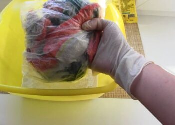 Nebegalvokite, kodėl virtuviniai rankšluosčiai smirda: paprastas 2 min. triukas su muilu ir maišeliu