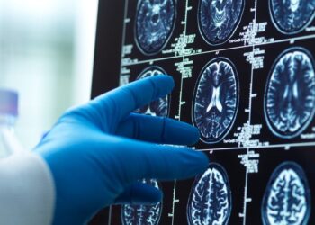 Pabundate su šiais simptomais? Jie gali būti susiję su demencijos rizika