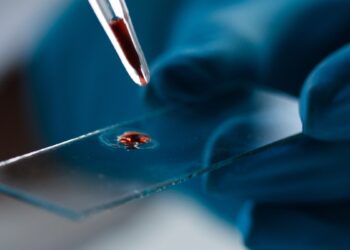 evoliucinis kraujo tyrimas: Alzheimerį gali parodyti dar prieš pirmuosius simptomus